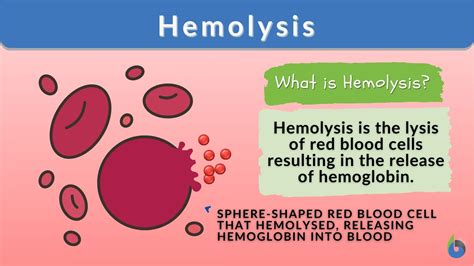 Hemolysis: Types, causes, and treatments .